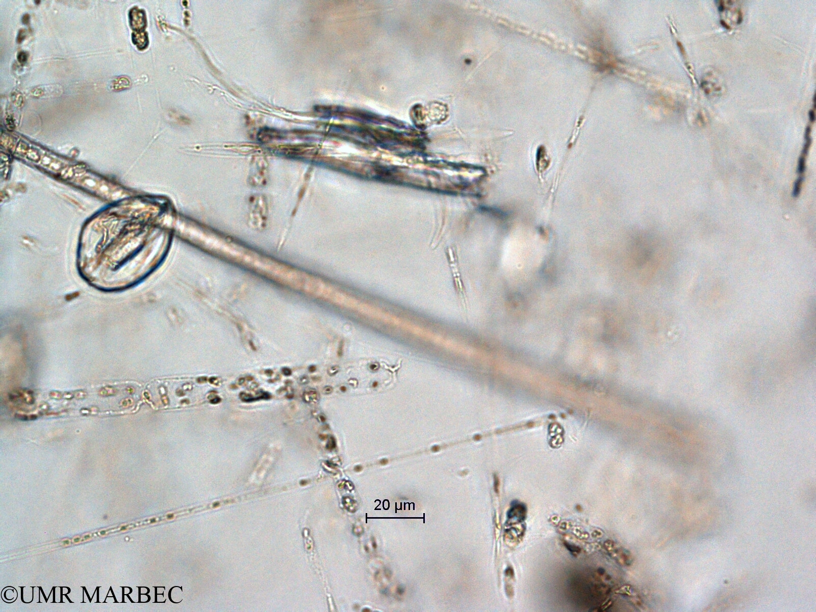 phyto/Scattered_Islands/all/COMMA April 2011/Dactyliosolen fragilissimus (ancien Guinardia striata-Guinardia sp2 recomposé)(copy).jpg